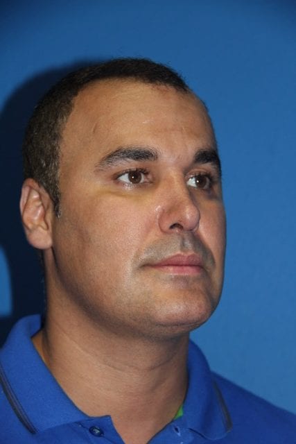 Male Rhinoplasty Patient 01 View 1 - After