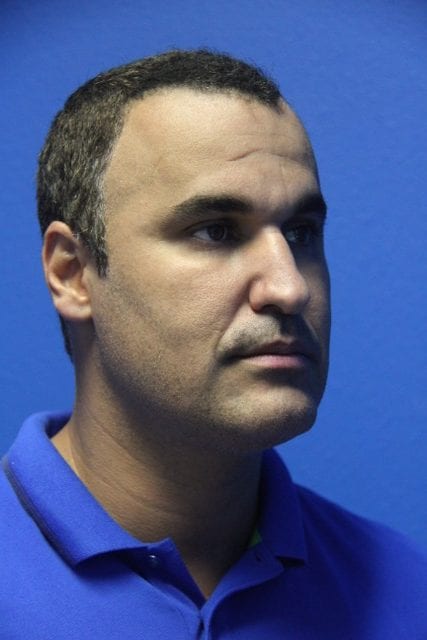 Male Rhinoplasty Patient 01 View 1 - Before