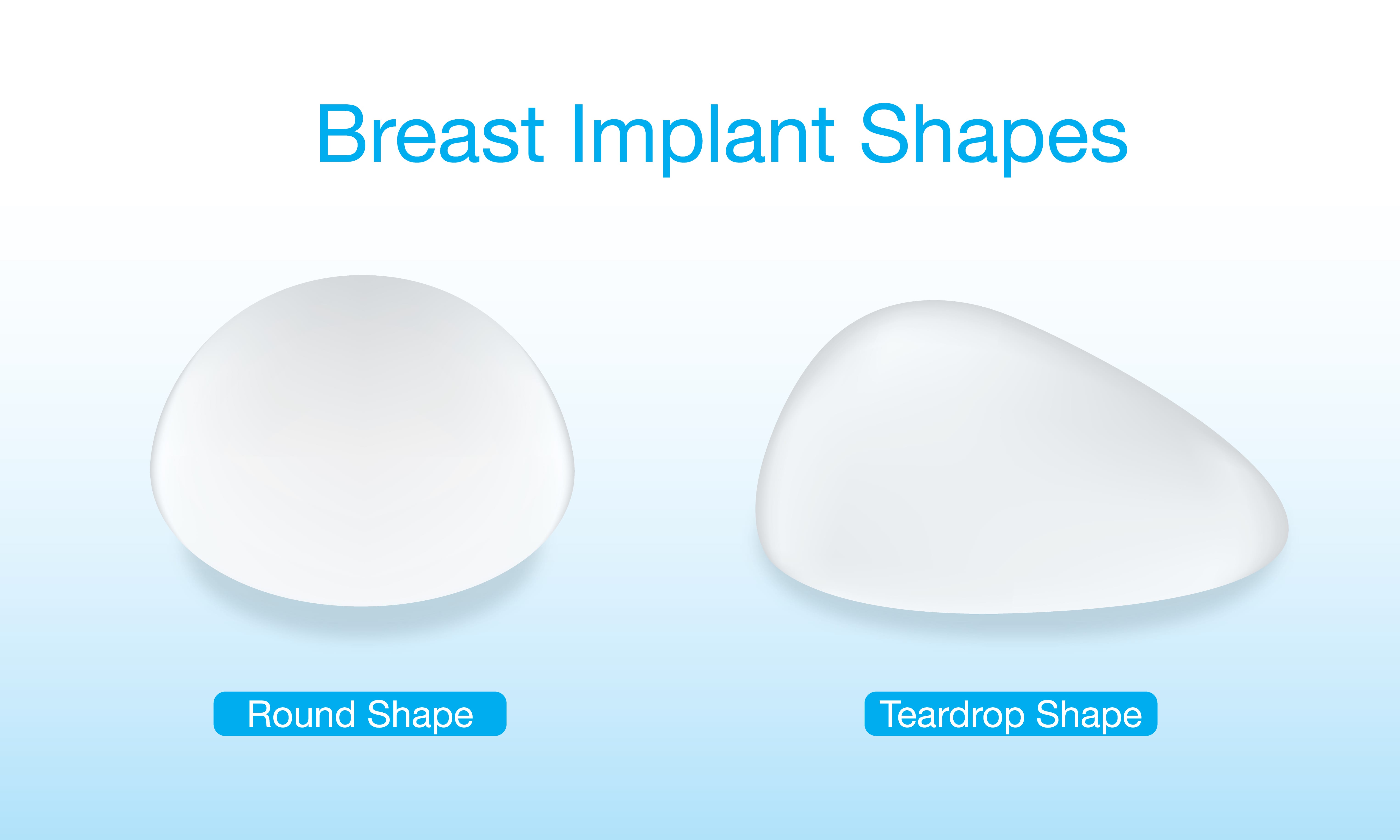 Should I Get Round or Shaped Breast Implants?