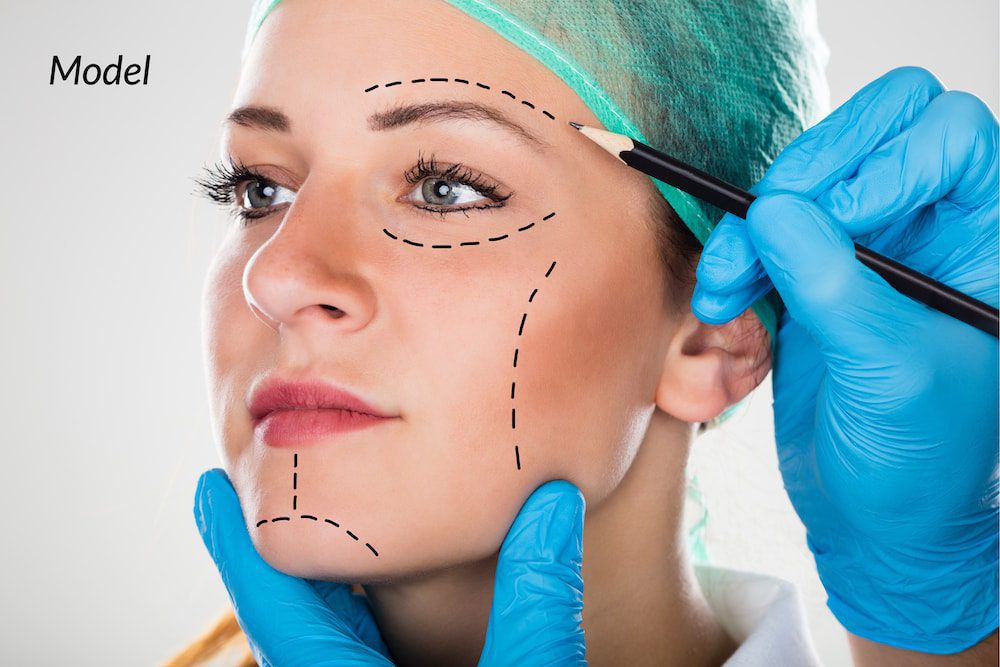 A woman undergoing a facelift consultation.