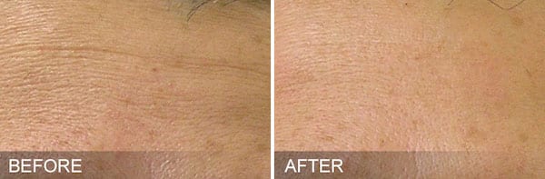 Before And After Patient