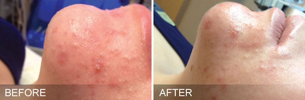 Before And After Patient