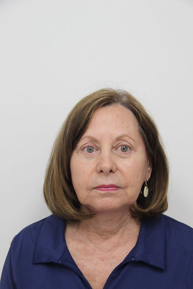 Case--2520 | After Eyelid Surgery / Blepharoplasty 1