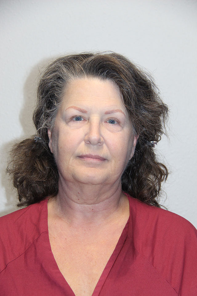 Case--3840 | Before Eyelid Surgery / Blepharoplasty 1